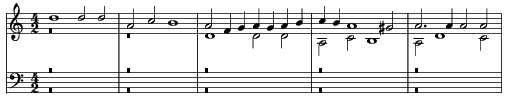 Music preview