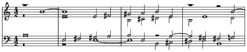 Music preview