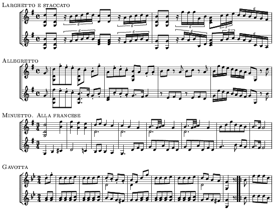 Music preview