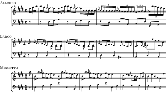 Music preview
