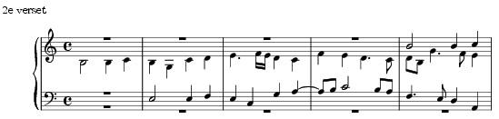Music preview