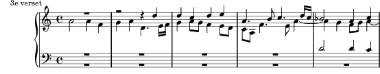 Music preview