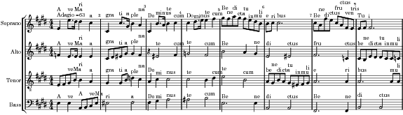 Music preview
